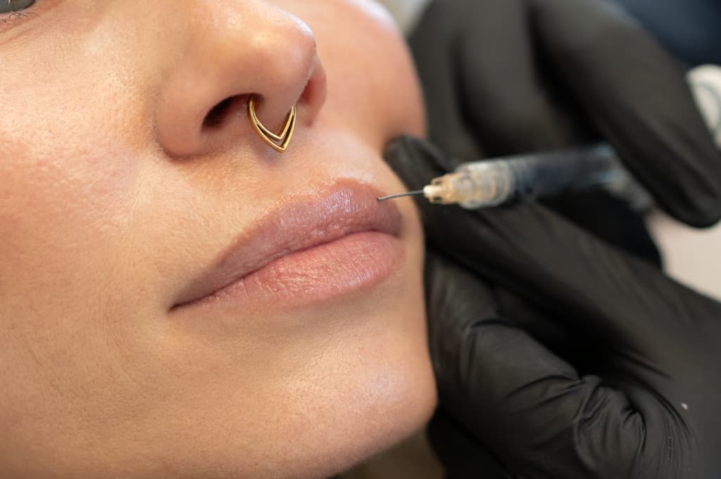 Lippen (0,5 – 0,7 ml)