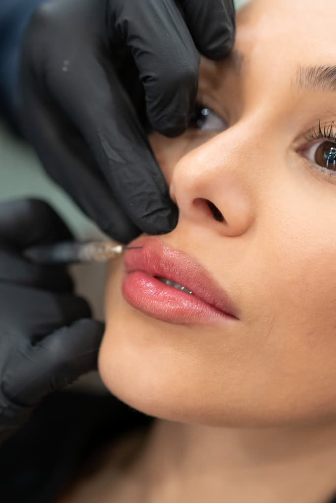 Lippen (1 ml)